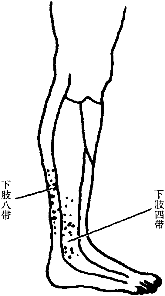 八、多發(fā)性神經(jīng)炎